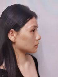 -长沙雅美医疗美容医院