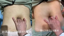 -产后帮产后修复(首城国际店)