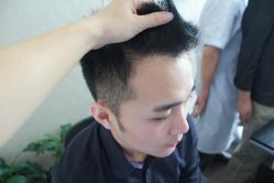 点击看大图 -大麦微针植发丨全国连锁