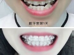 -团圆口腔·种植中心(锦江院区)