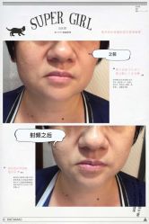 光SPA小V脸-光SPA科技美肤