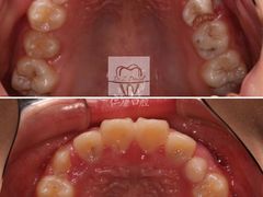 -Dr.Z dental仁康种植矫正中心