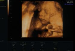 -郑州万安妇产医院