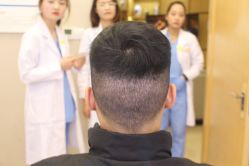 -大麦微针植发丨全国连锁