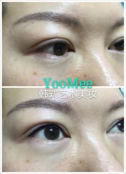 -YooMee优美智能科技美肤机构