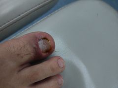 -新甲连锁灰指甲·甲沟炎·鸡眼(黑龙江路店)