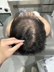 -熙朵美学植发·连锁品牌