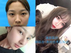 -上海漾颜医疗美容