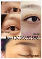iphone_upload_pic-百秀名媛纹绣美学护肤中心