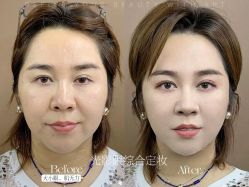 -西施无菌半永久纹绣眉眼影唇轻增发纹发际线