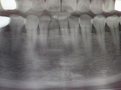 -土豆口腔(凤凰北总店)