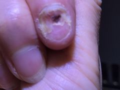 -Andrew指甲专科灰指甲·甲沟炎矫正·3D步态矫形鞋垫定制(上海法华镇路旗舰店)