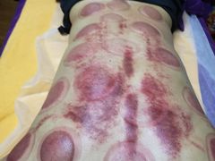 -沈师傅盲人按摩工作室(密三小区店)