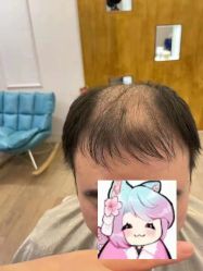 -乐绅男士高端假发定制
