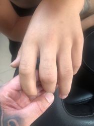 -秦好山专业洗纹身