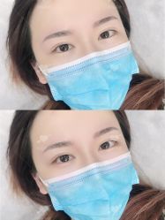 点击看大图 -西施无菌半永久纹绣眉眼影唇轻增发纹发际线