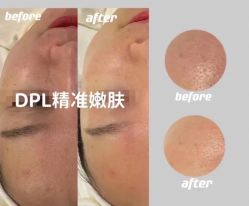 -MUFI·美悦菲塑颜美容SPA