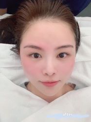 -LUNA皮相美·骨相美高级美感