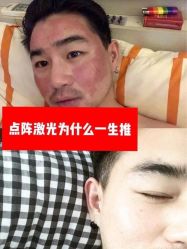 体验后-北京米扬丽格医疗美容·联合丽格鼻整形中心
