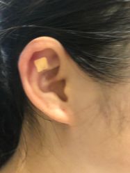-肥三针腧穴瘦身馆