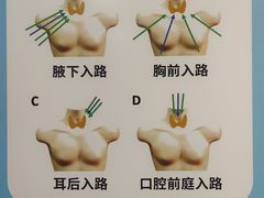 -天津医科大学肿瘤医院(本部院区)