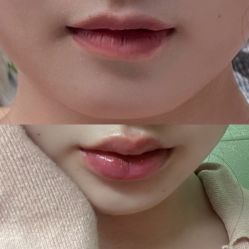 体验前-上海漾颜医疗美容