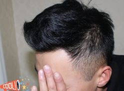 -大麦微针植发丨全国连锁