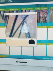 点击看大图 -博士园养发馆