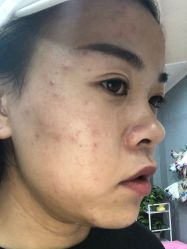 点击看大图 -痘院士专业祛痘皮肤管理