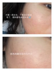 -慕颜医疗美容·皮肤微整 抗衰