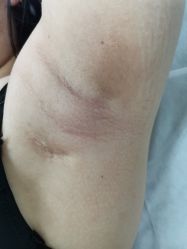 -中科妍美专业脱毛美肤连锁机构