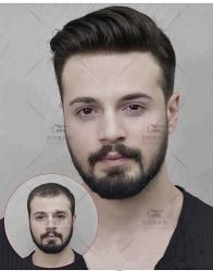 -发饰美男士增发补发假发定制店