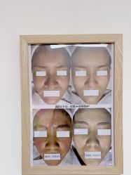 -美肤盾祛痘·问题肌头疗管理中心