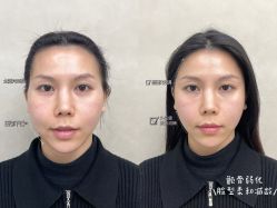 -素美医疗美容·西南眼鼻整形·修复基地