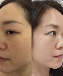 -SKIN79皮肤管理中心