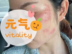 -中国医学科学院皮肤病医院