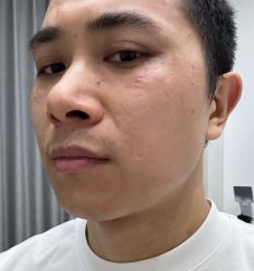 体验后-科佳医疗美容·轻医美