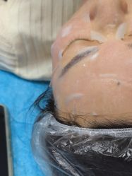 -长沙雅美医疗美容医院