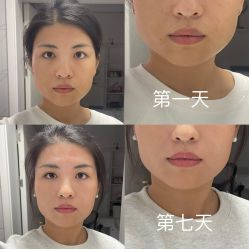 -成都西区医院整形美容