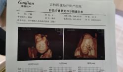 -吉林国健妇产医院(经开院区)