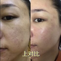 体验前-天津伊美尔医疗整形美容专科医院