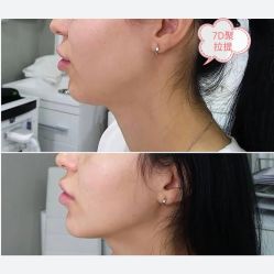 -上海漾颜医疗美容