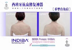 -Fundi张玉珊修身堂·indiba·BTL科技瘦身
