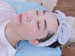 体验后-东莞缔美美容医院