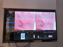 -苑苑vbeauty科技美容SPA