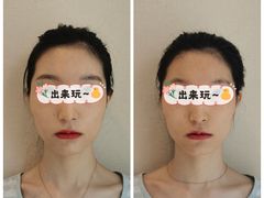 -FACE·日本小颜美容整骨(福田店)