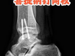 -衢州大荫山丛林飞越探险乐园