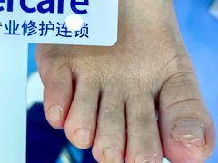 -Andrew指甲专科灰指甲·甲沟炎矫正·3D步态矫形鞋垫定制(浦三路店)