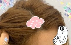 -大麦微针植发全国连锁