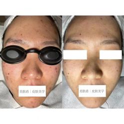 -美肤盾祛痘·问题肌头疗管理中心